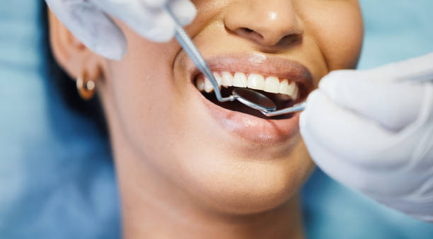 Best Emergency Dental Care for Sports Injuries in Millington, NJ